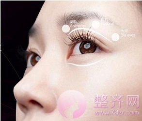 双眼皮,割多宽才好看?