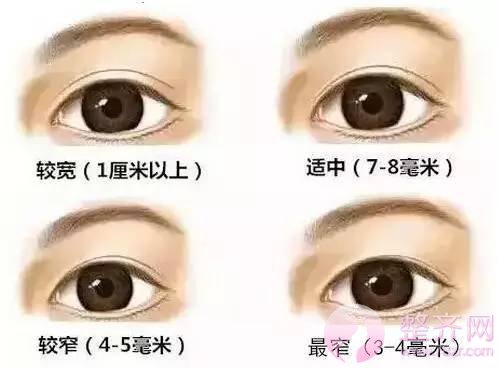 双眼皮,割多宽才好看?