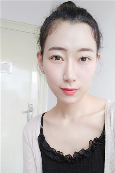 姐妹们,看看长沙妹子的鼻部手术经历吧~~好看的皮囊永远都跟个开挂了一样嘿嘿