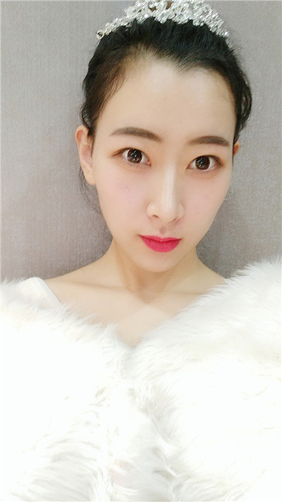 姐妹们,看看长沙妹子的鼻部手术经历吧~~好看的皮囊永远都跟个开挂了一样嘿嘿