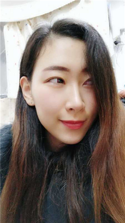 姐妹们,看看长沙妹子的鼻部手术经历吧~~好看的皮囊永远都跟个开挂了一样嘿嘿
