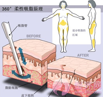 春天瘦夏天秀!只要一招就能满足你的小“腰”