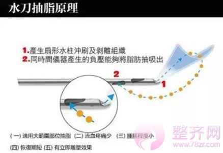 春天瘦夏天秀!只要一招就能满足你的小“腰”