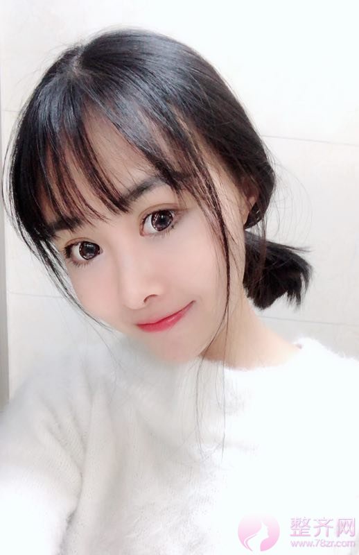 同样是埋线,为什么你的维持时间那么短?