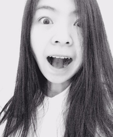 牙齿矫正术前术后对比案例,和牙套君恋爱的日子,不再做龅牙妹!