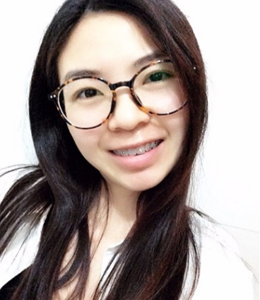 牙齿矫正术前术后对比案例,和牙套君恋爱的日子,不再做龅牙妹!