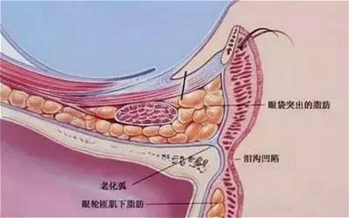 解决眼袋、黑眼圈,老阿姨秒变小姐姐