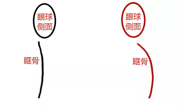 解决眼袋、黑眼圈,老阿姨秒变小姐姐