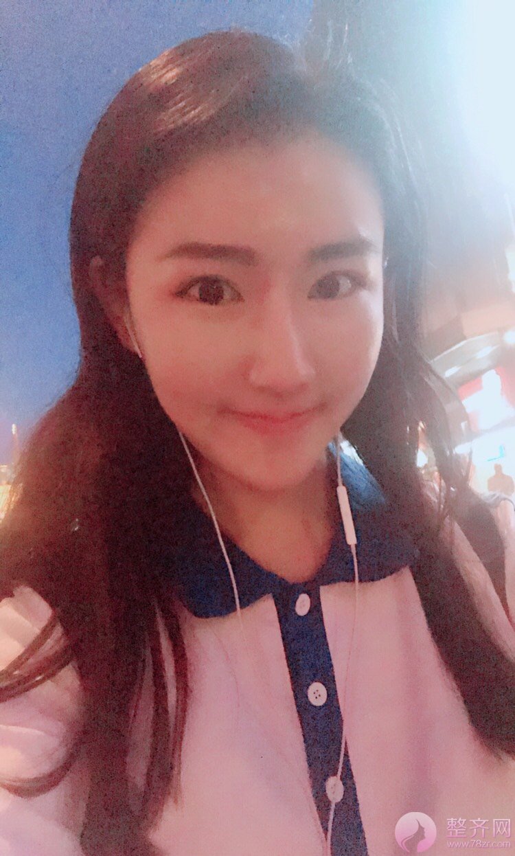 漂亮的额头到底长什么样?发际线来告诉你