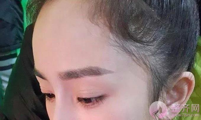 漂亮的额头到底长什么样?发际线来告诉你