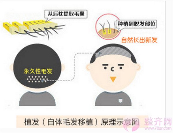 漂亮的额头到底长什么样?发际线来告诉你