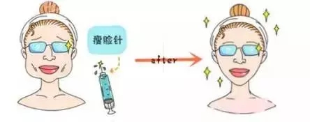 玻尿酸注射,让你拥有高鼻梁和甜美的五官