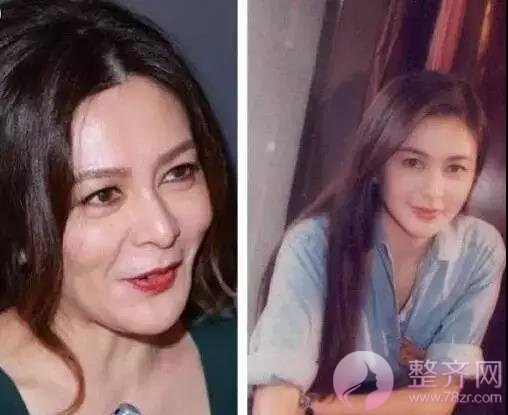 面部凹陷的女人为什么会显老10岁?
