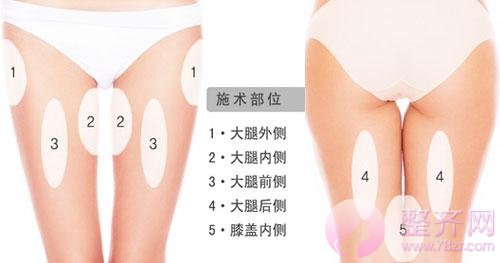 抽脂减肥手术对身体有危害吗?
