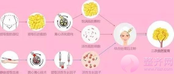 自体脂肪移植填充,又瘦又美!