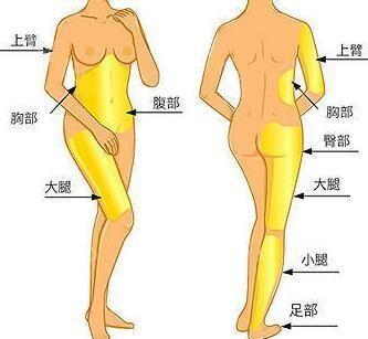 吸脂手术等于减肥?你要是不节制,吸再多也没