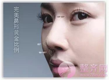 膨体隆鼻+耳软骨,鼻尖保护和塑性两不误!