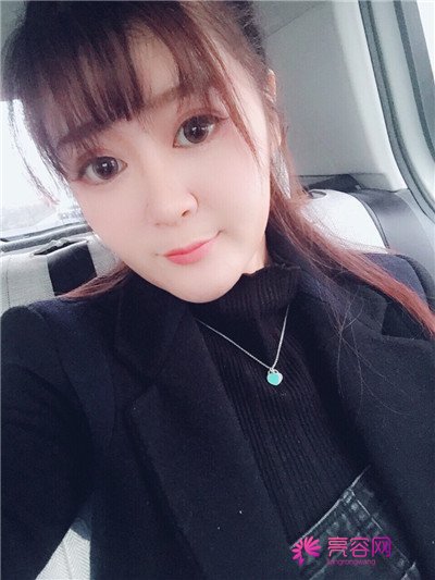 昨天有小主咨询瘦脸,让我多发点瘦脸的案例,这不,我就给大家分享一篇瘦脸,脸盘大的妹子可以看看哦,看看能否有经验可以学习到,哈哈哈~~~~