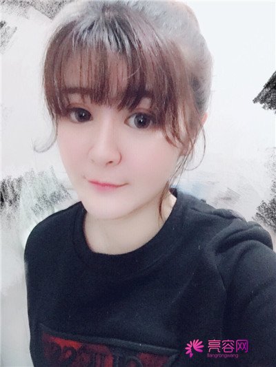 昨天有小主咨询瘦脸,让我多发点瘦脸的案例,这不,我就给大家分享一篇瘦脸,脸盘大的妹子可以看看哦,看看能否有经验可以学习到,哈哈哈~~~~