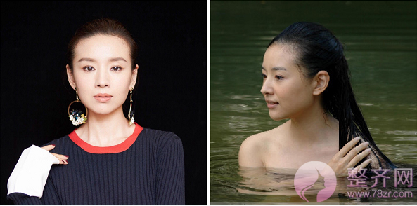 小翘鼻?水滴鼻?希腊鼻?你想要的鼻型是哪一
