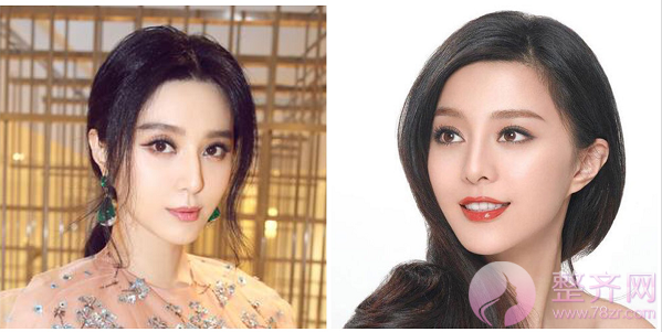 小翘鼻?水滴鼻?希腊鼻?你想要的鼻型是哪一