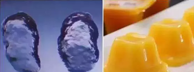 玻尿酸隆鼻,给你不一样的美丽!
