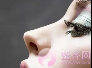 鼻翼缩小怎么做?我来告诉你!