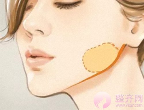 大脸有多心塞?想要瘦脸怎么破?