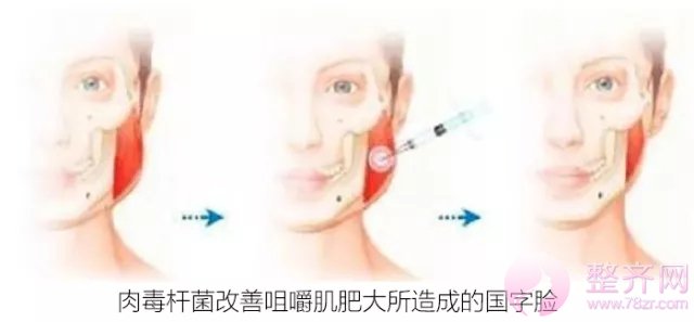 大脸有多心塞?想要瘦脸怎么破?