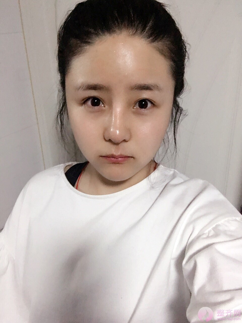 大脸有多心塞?想要瘦脸怎么破?