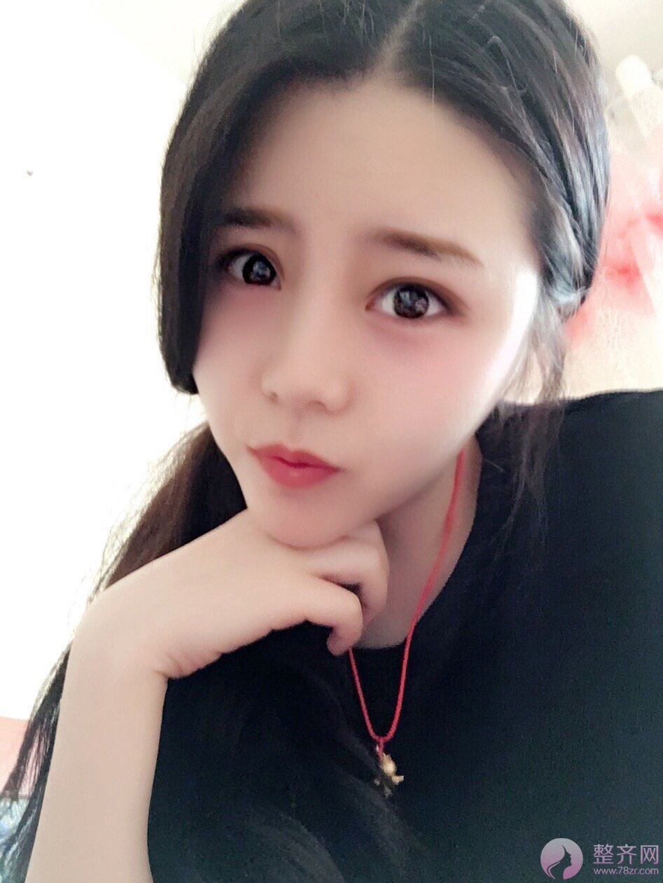 大脸有多心塞?想要瘦脸怎么破?
