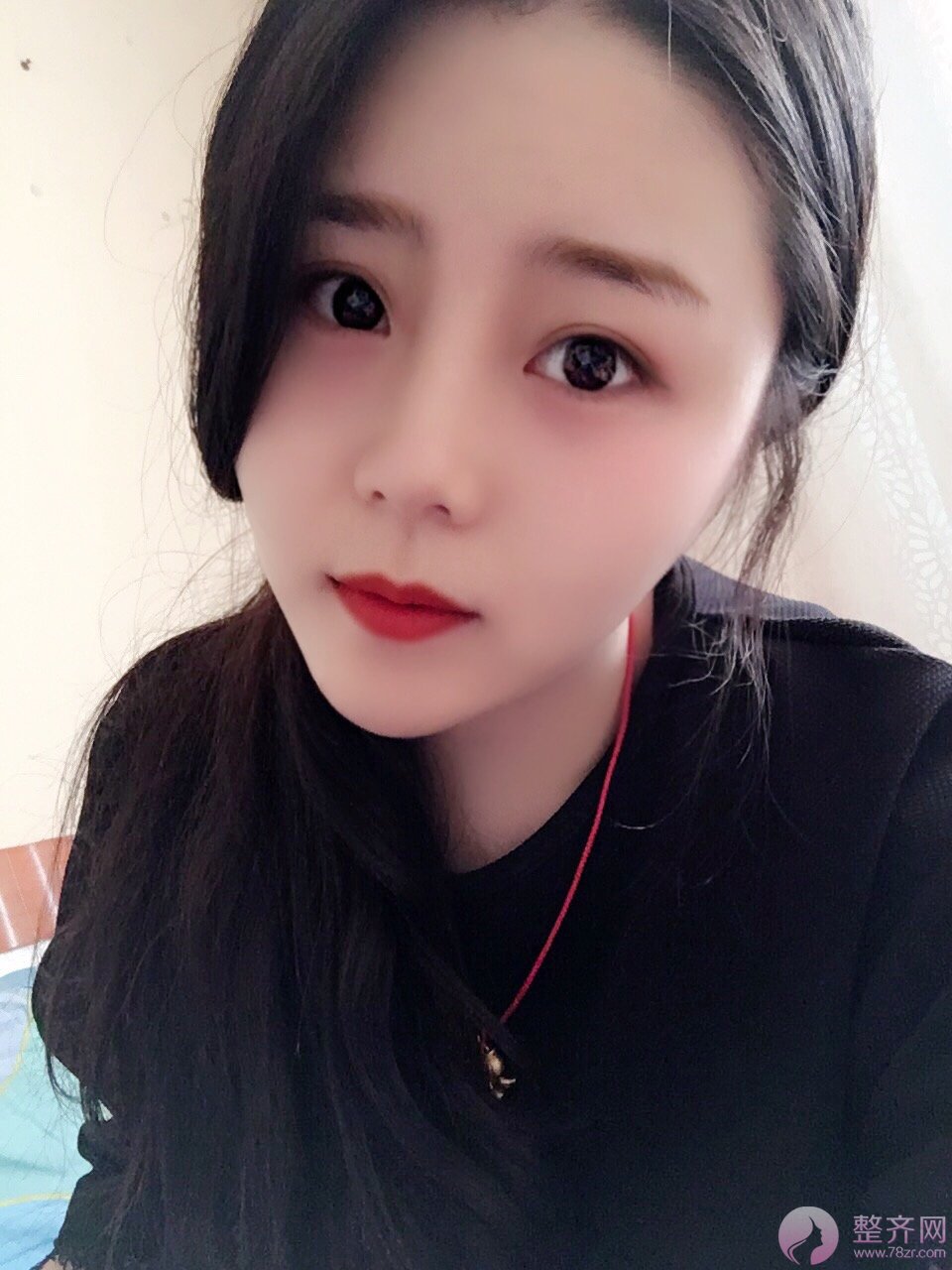 大脸有多心塞?想要瘦脸怎么破?