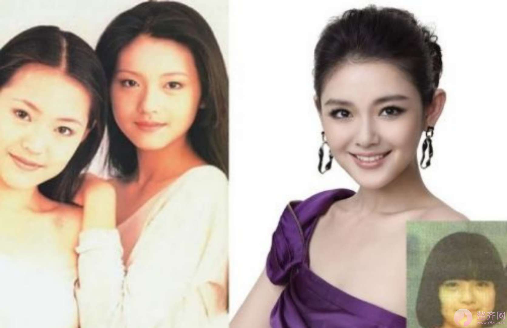 下颌角真的非去不可吗?