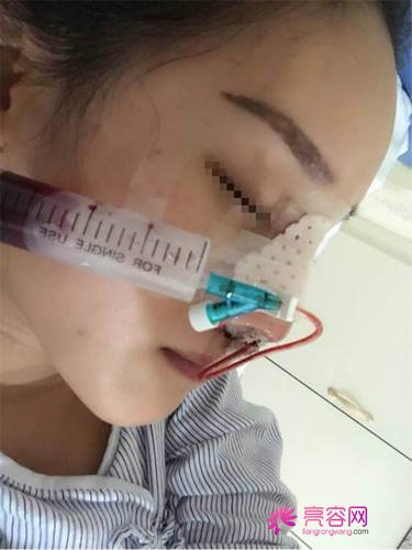 5.1小长假姐妹在干嘛?旅行?出行?想变美的人看过来!!分享我的变美经历啦~~~
