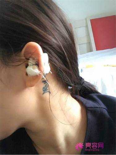 5.1小长假姐妹在干嘛?旅行?出行?想变美的人看过来!!分享我的变美经历啦~~~