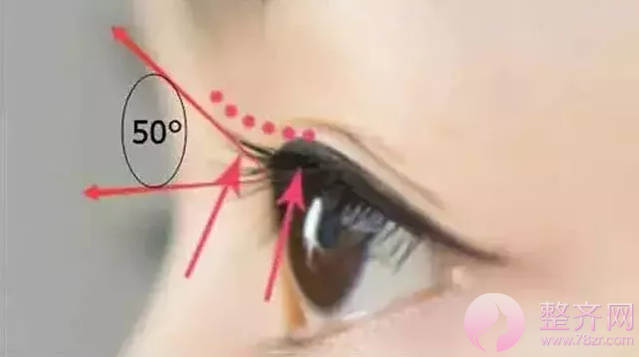 双眼皮,什么样的方式才适合自己?