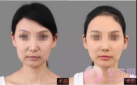 如何修炼出唐嫣的少女感?