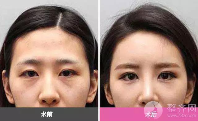如何修炼出唐嫣的少女感?