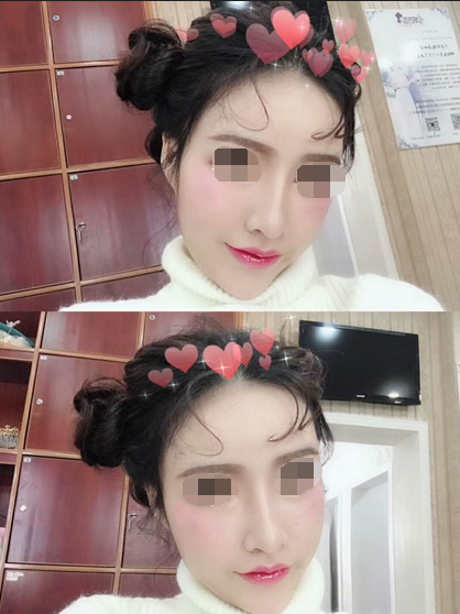 告别朝天鼻,再也不是猪鼻妹