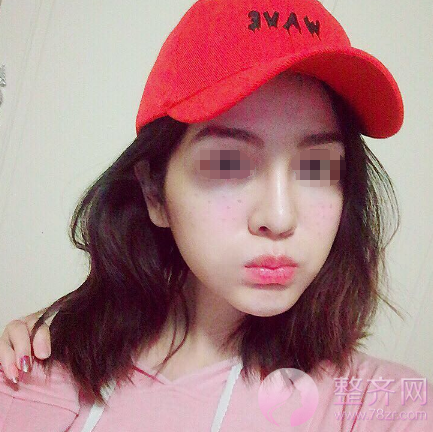 下巴决定脸型,颜值加分就靠它