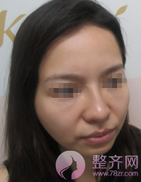 下巴决定脸型,颜值加分就靠它