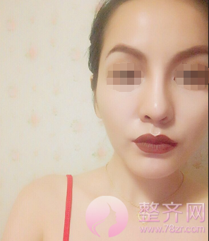 下巴决定脸型,颜值加分就靠它
