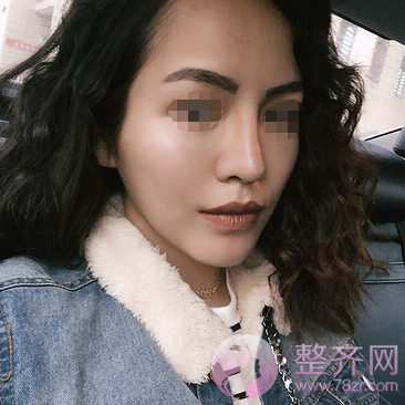 下巴决定脸型,颜值加分就靠它