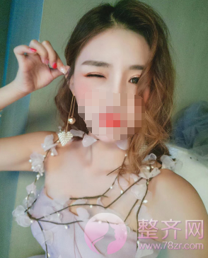 多大做双眼皮才合适?