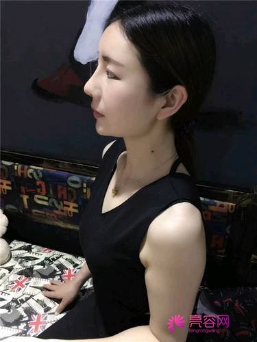 自从做了脂肪自体填充后心情很好,再也不怕和朋友出去聚餐了!!变得美美的,大家可不要羡慕我哦