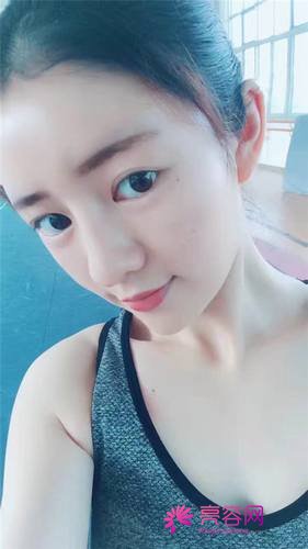 自从做了脂肪自体填充后心情很好,再也不怕和朋友出去聚餐了!!变得美美的,大家可不要羡慕我哦