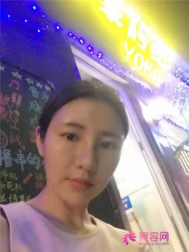 自从做了脂肪自体填充后心情很好,再也不怕和朋友出去聚餐了!!变得美美的,大家可不要羡慕我哦