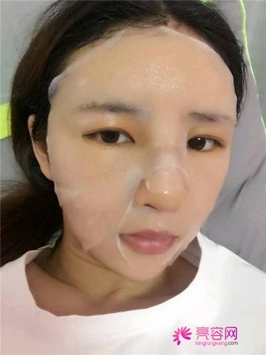 自从做了脂肪自体填充后心情很好,再也不怕和朋友出去聚餐了!!变得美美的,大家可不要羡慕我哦