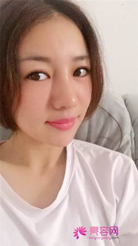 自从做了脂肪自体填充后心情很好,再也不怕和朋友出去聚餐了!!变得美美的,大家可不要羡慕我哦