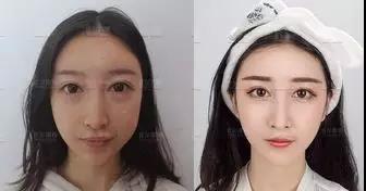 卧蚕美10倍,眼袋老10年